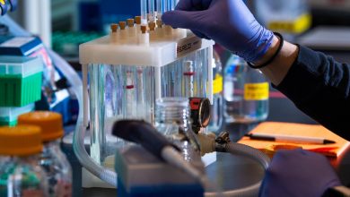 صورة دراسة علمية تكشف: دم الإبل واللاما قد يفتح آفاقًا جديدة لعلاج الزهايمر